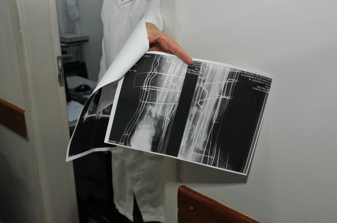 No Hospital Regional, o raio-x estão sendo impressos em papel A4
