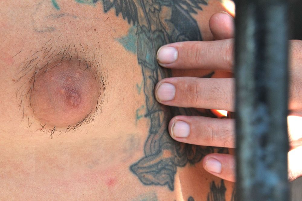 Detento diz que foi diagnóstigado com câncer de mama há três meses e desde então não iniciou o tratamento